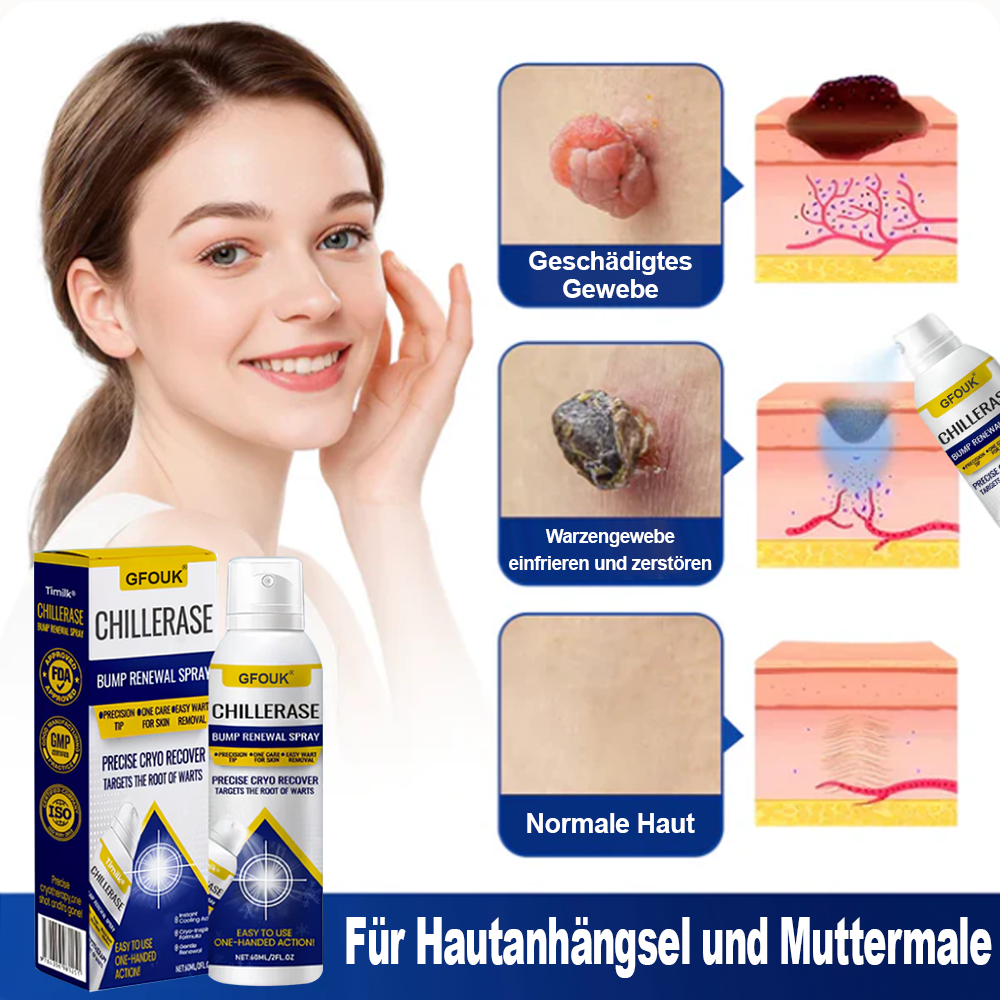 ChillErase Spray zur Pickel- und Hauterneuerung
