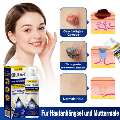 ChillErase Spray zur Pickel- und Hauterneuerung