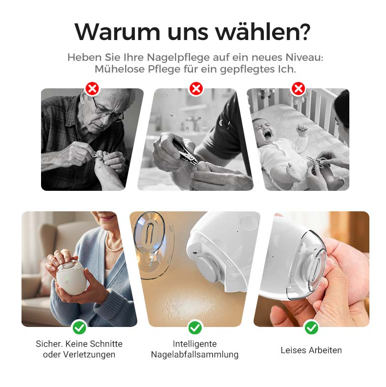 80%Universeller automatischer Fingernagelschleifer für Erwachsene und Kinder – Einfach & Sicher